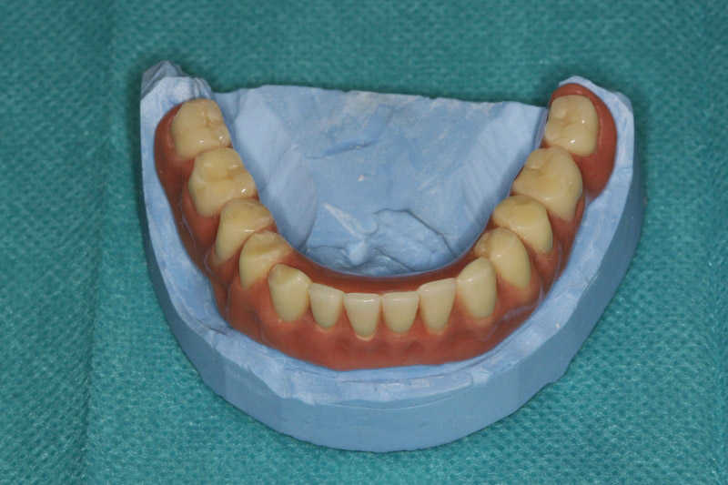 58