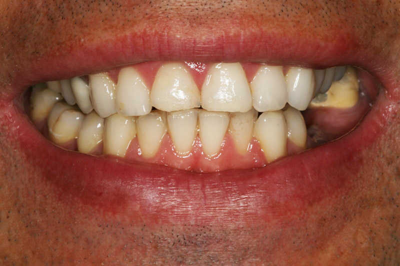 96